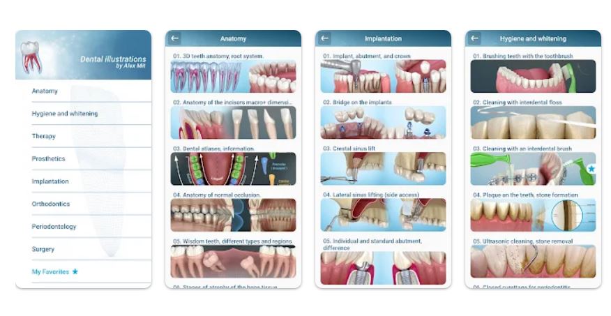 Dental 3D Illustrations Review